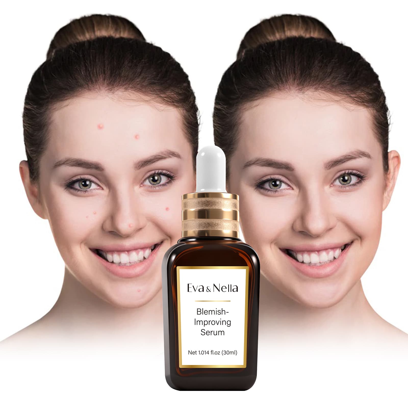 Blemish-Improving Serum — vista 2