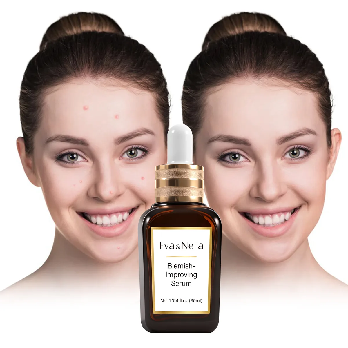 Blemish-Improving Serum — vista 2